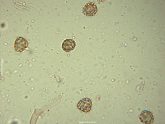 Tomentella asperula