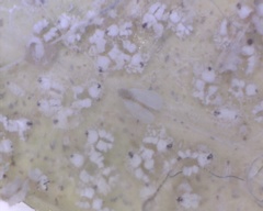 Siphoninus phillyreae