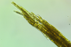 Aphanizomenon flosaquae