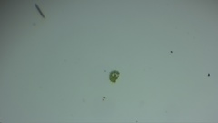 Pseudopediastrum boryanum