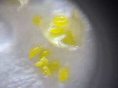 Phyllocoptruta coryli