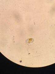 Cocconeis