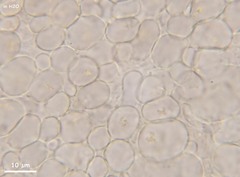 Orbilia luteorubella