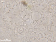 Orbilia luteorubella