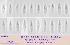 Orbilia luteorubella