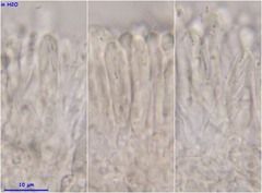Orbilia luteorubella