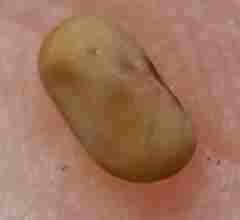 Tephrosia semiglabra