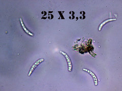 Hymenoscyphus serotinus