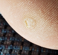 Firstpapillomavirinae