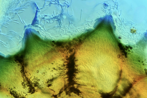 Scarlet Caterpillar Club