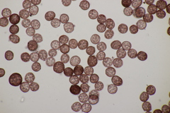 Sphacelotheca hydropiperis