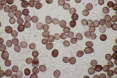 Sphacelotheca hydropiperis