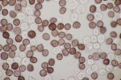 Sphacelotheca hydropiperis