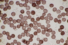 Sphacelotheca hydropiperis