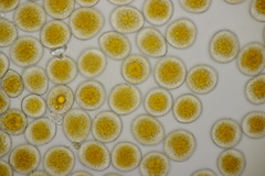 Puccinia coronata