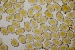 Puccinia graminis