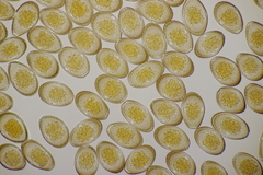 Puccinia graminis