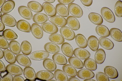 Puccinia graminis