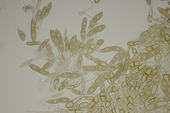Puccinia malvacearum