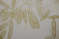 Puccinia malvacearum
