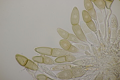 Puccinia malvacearum
