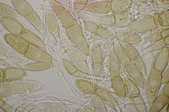 Puccinia malvacearum