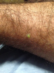 Kallitaxila granulata