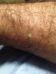 Kallitaxila granulata