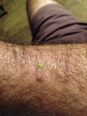 Kallitaxila granulata