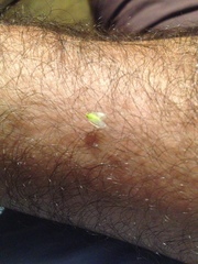 Kallitaxila granulata