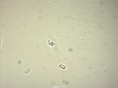 Clavaria krieglsteineri