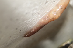 Gastropoda