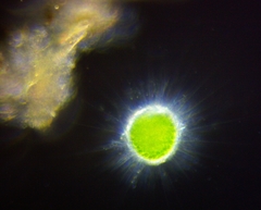 Acanthocystis