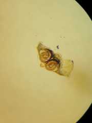 Parasteatoda cingulata