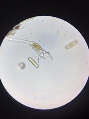 Collotheca