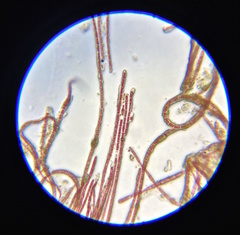 Rhodochorton purpureum