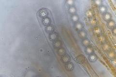 Octospora maireana