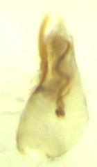Baeocera actuosa
