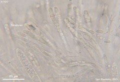 Hymenoscyphus dearnessii