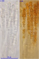 Hymenoscyphus dearnessii