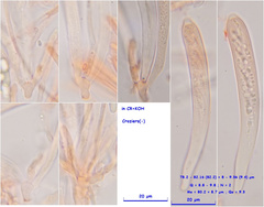 Hymenoscyphus dearnessii
