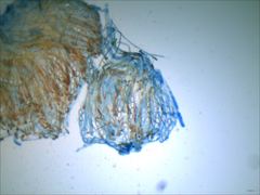 Scutellinia vitreola