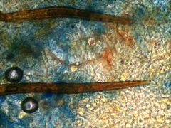 Scutellinia vitreola