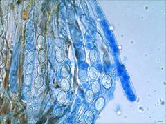 Scutellinia vitreola