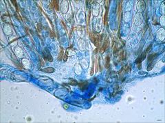 Scutellinia vitreola