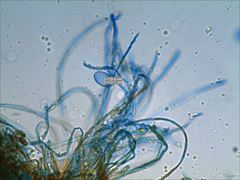 Scutellinia vitreola