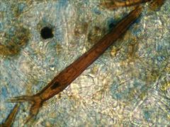 Scutellinia vitreola