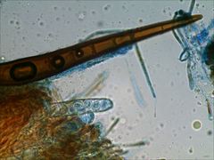 Scutellinia vitreola