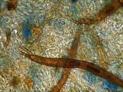 Scutellinia vitreola