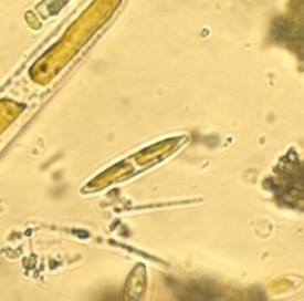 Nitzschia palea
